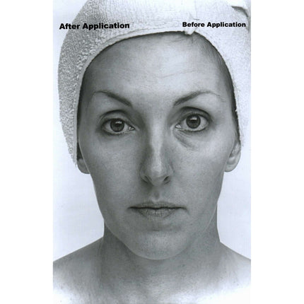 Collagen Lifting Facial With Rapid Wrinkle Erase Cream